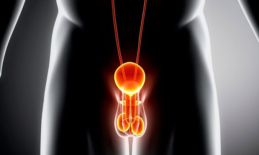 Sistem genitourinar inflamat pentru prostatită